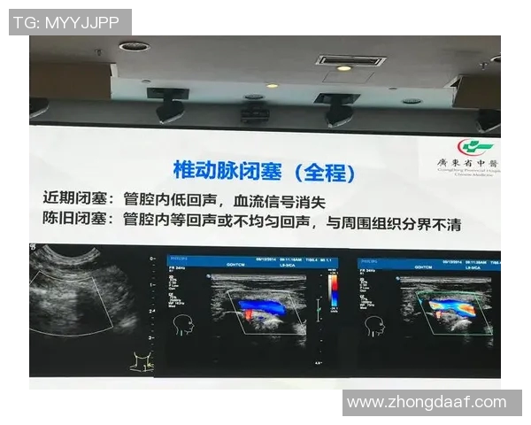 布尔格与索肖的对决分析及双方近期状态评估 布尔格与索肖的对决分析及双方近期状态评估